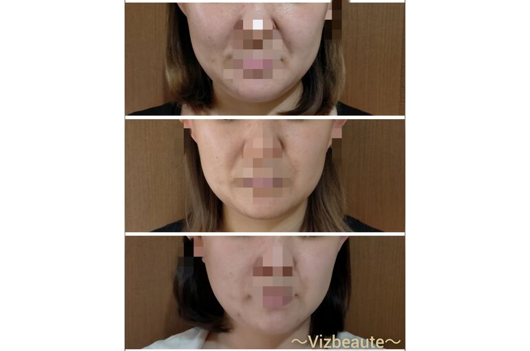 BeautyPlus_20210508085214889_save