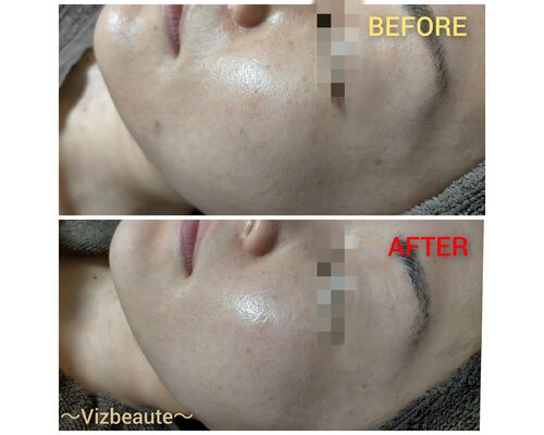 BeautyPlus_20210329090807247_save