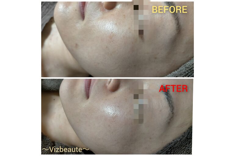 BeautyPlus_20210329090807247_save