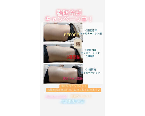 D6C6448D-A4BF-420C-BD11-77CDC34403E1