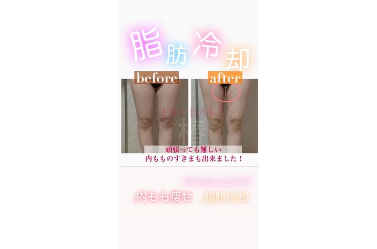 9B790B3D-1A6A-4D2B-8572-E1E12AA59FF9