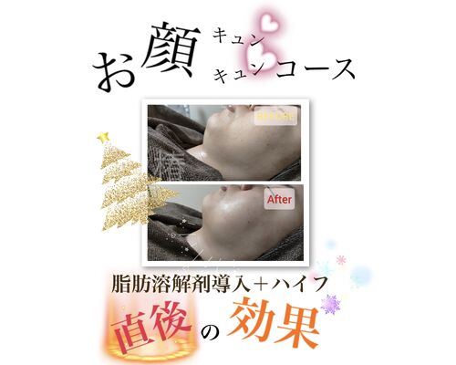 E1F2470E-38D2-4D90-A94C-E64FCB1F882A