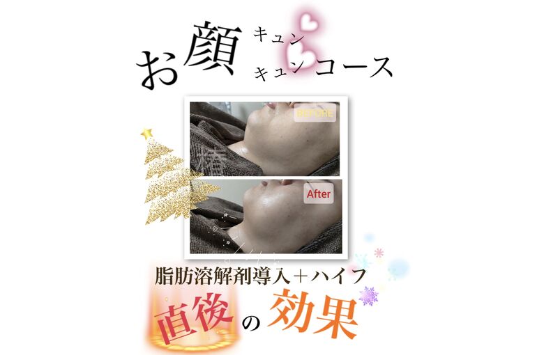 E1F2470E-38D2-4D90-A94C-E64FCB1F882A