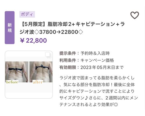 A2AC4D2D-E823-4722-A601-AF9C95B160D3