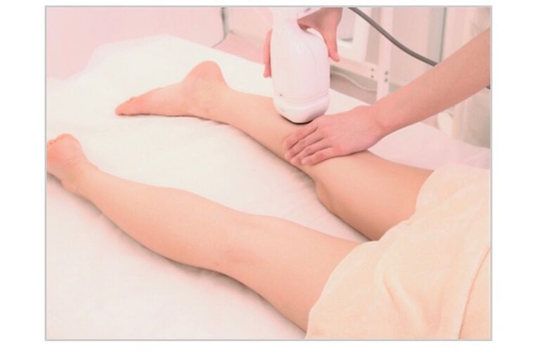 blog4